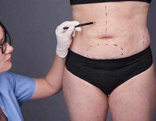 Bariatric surgery may change gene expression in fat tissue