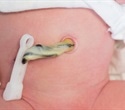Scientists Identify Biological Link Between Low Birth Weight and Chronic Disease