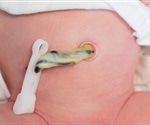 Study reveals a tug-of-war between genes inherited from the father and the mother