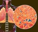 Genetic Sequencing Breakthrough Reveals Rapid Spread of New Pathogens