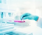 Ionic Fluids for Microextraction in Forensic Toxicology