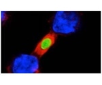 Peptide therapy prevents overreaction of the immune system against infections