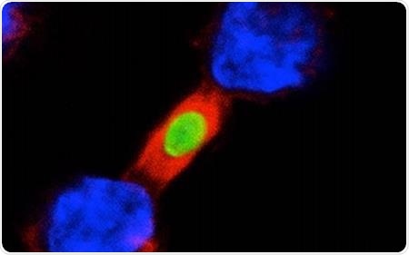 Peptide therapy prevents overreaction of the immune system against infections