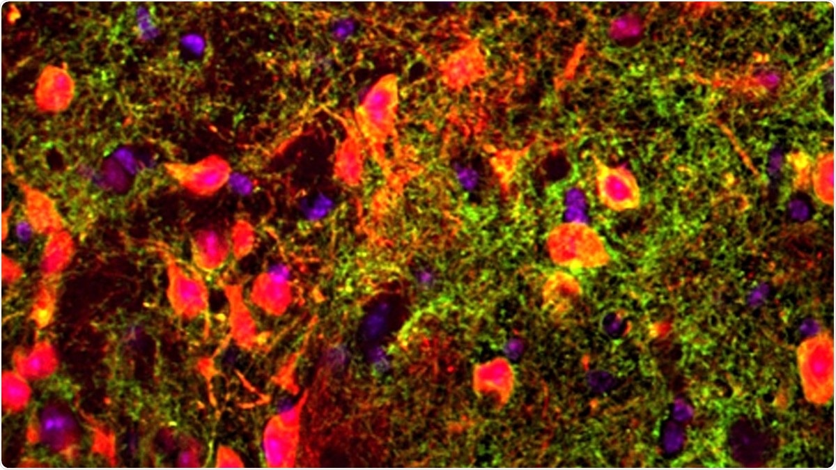 Scientists discover new genes and brain circuits crucial for short-term memory