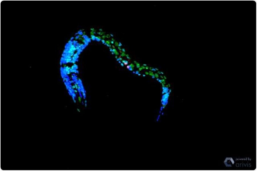 Novel mechanism restores cell function after DNA damage