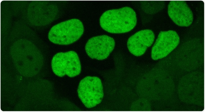 Researchers propose new way to exploit the weaknesses of cancer cells