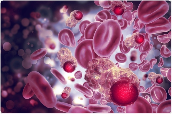 Blood Cancer Blood Cancer