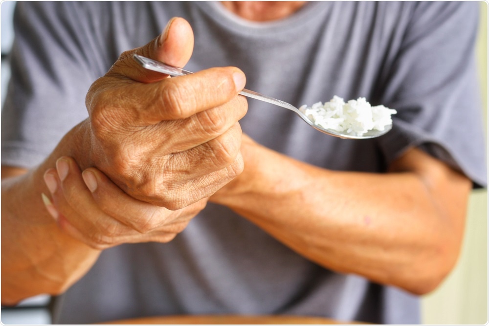 Parkinsons Disease Parkinsons Disease