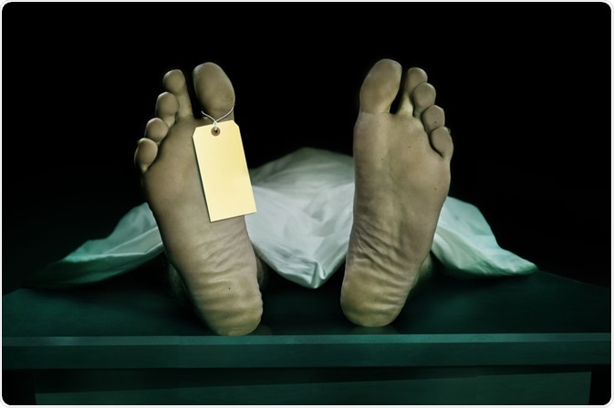 Post-Mortem Post-Mortem