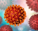 Supercomputer analyses point to a new pathway for COVID-19 inflammatory response