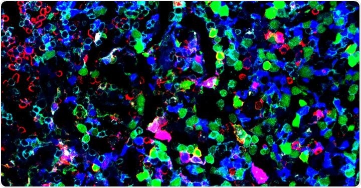 Immune Cells Immune Cells
