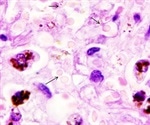 Study probes mechanism by which COVID-19 distribution in the body damages erythrocytes