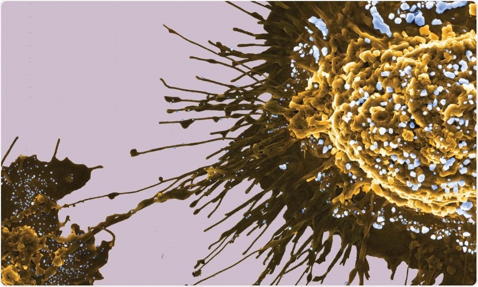 Researchers use metal-organic frameworks to target prostate cancer cells