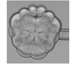 Researchers explain how tissue tension influences the orientation of cell division
