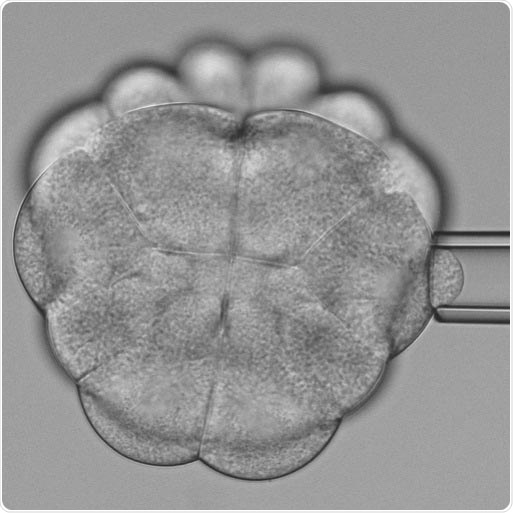 Researchers explain how tissue tension influences the orientation of cell division
