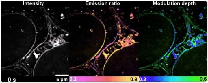 Researchers use new technique to visualize the sophisticated world of lipid dynamics