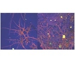 Study shows soil bacteria rely on fungi to survive dry periods