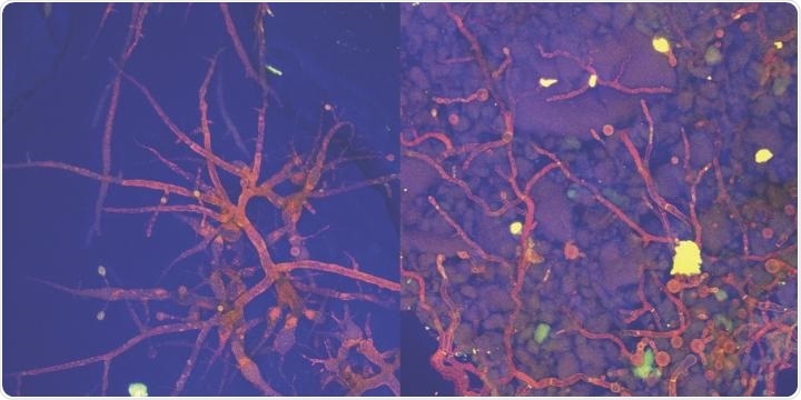 Study shows soil bacteria rely on fungi to survive dry periods