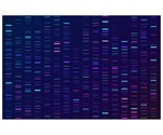 New approach can prevent toxicity linked to neurological gene therapy