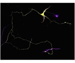 Study identifies molecular mutation more common in African Americans with late-onset Alzheimer’s