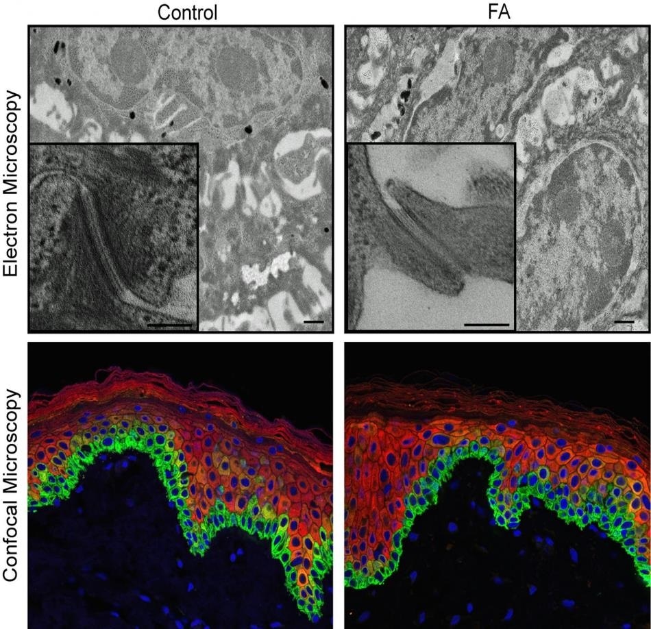 Scientists use new technology to observe DNA defects in children with Fanconi anemia