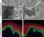Scientists use new technology to observe DNA defects in children with Fanconi anemia