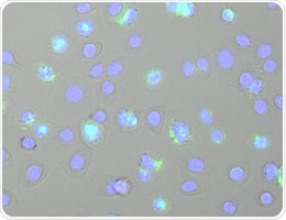 Study underlines the significance of epithelial against invasive pathogens