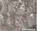 Researchers identify potential new treatments for blindness
