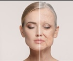 Computational method reveals a new hallmark of aging