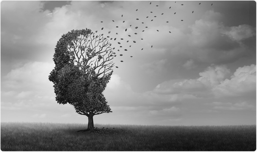 Alzheimers Disease Alzheimers Disease