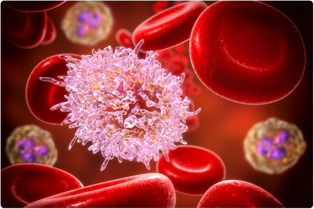 Hairy cell leukemia Hairy cell leukemia