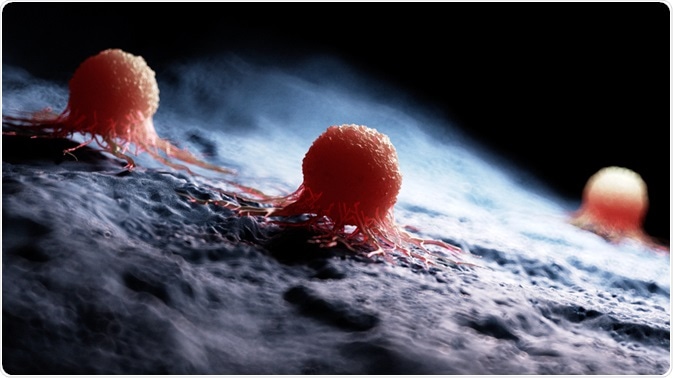 Tumor Cells Tumor Cells