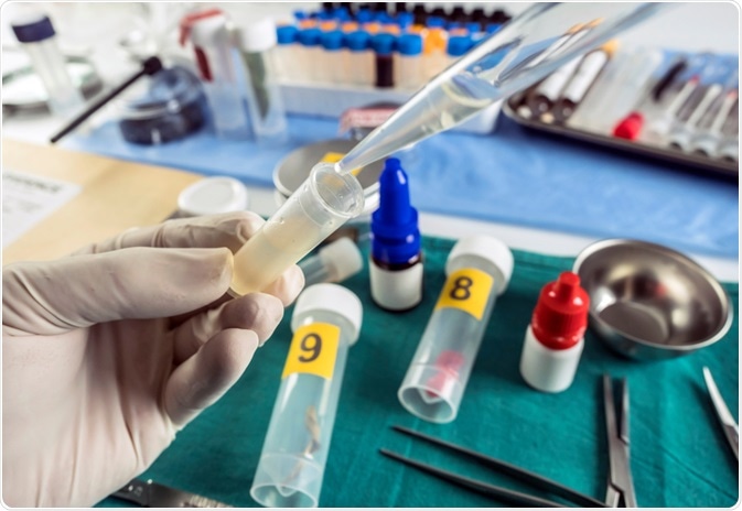 DNA Evidence DNA Evidence
