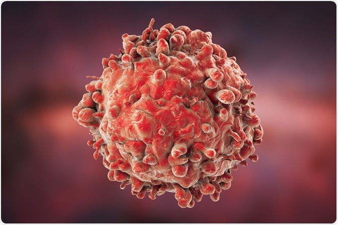 Leukemia Leukemia