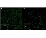 Researchers use super-resolution microscopy to study bacterial infection mechanisms