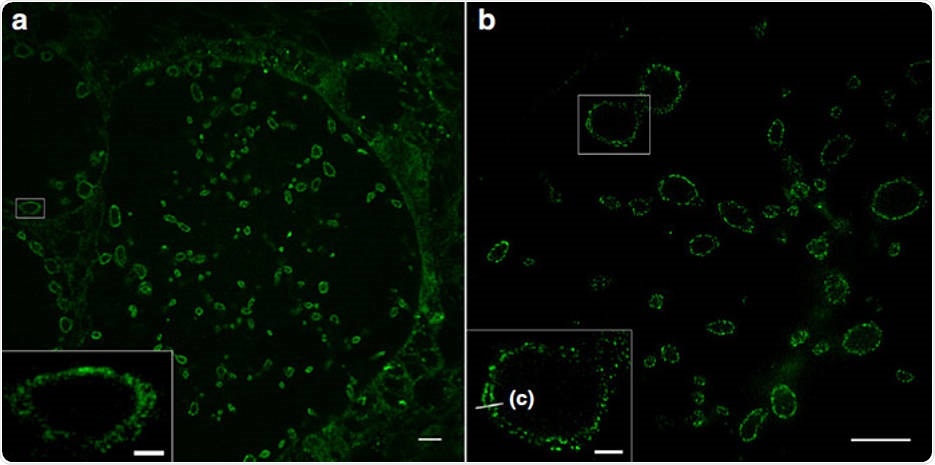 Researchers use super-resolution microscopy to study bacterial infection mechanisms