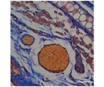 Scientists use honey bee peptide to design RBC carriers that deliver therapeutic proteins