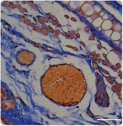 Scientists use honey bee peptide to design RBC carriers that deliver therapeutic proteins