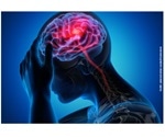 Study shows tRNA fragments play a key role in ischemic stroke