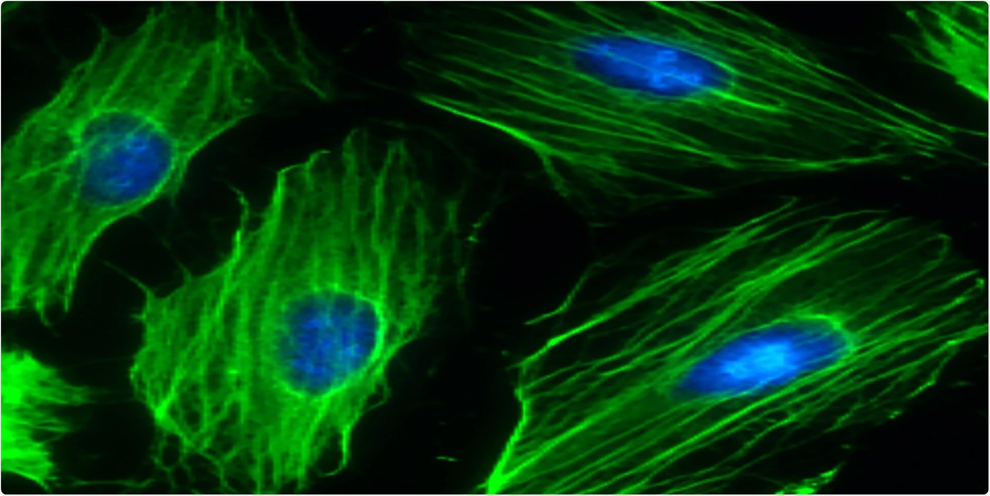 Gene therapy and medication can provide certain beneficial effects of physical exercise