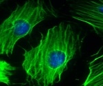 Gene therapy and medication can provide certain beneficial effects of physical exercise