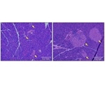 Researchers identify new therapeutic target to treat type 1 diabetes
