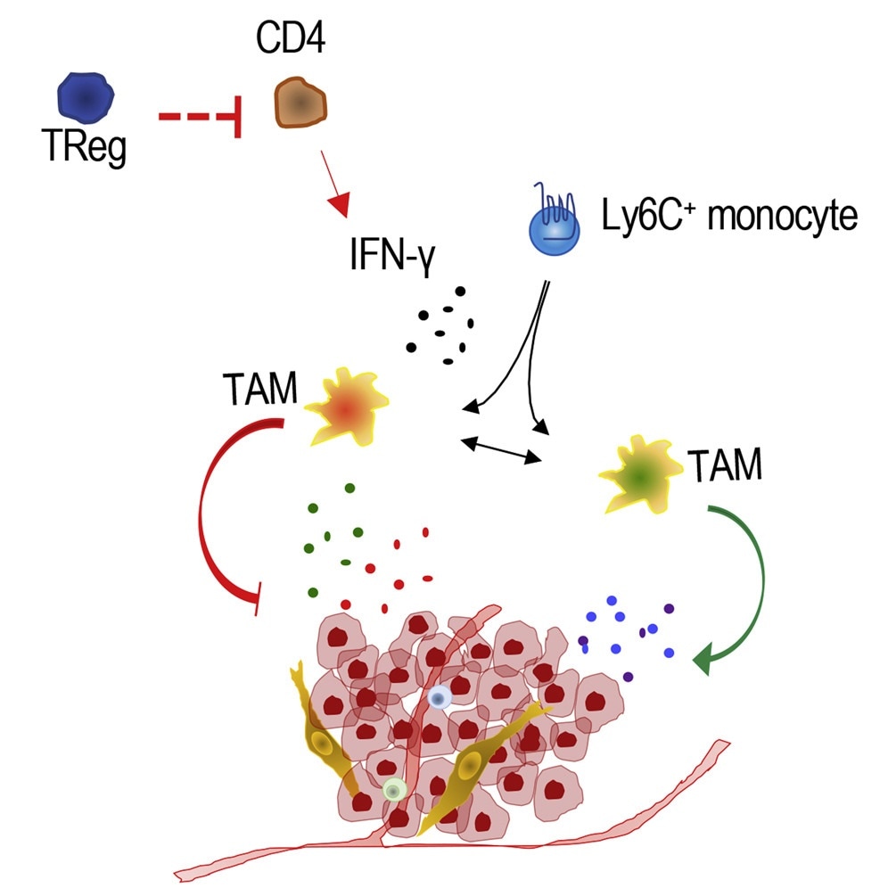 Researchers detect new immune cells that act as major driver of breast cancer growth