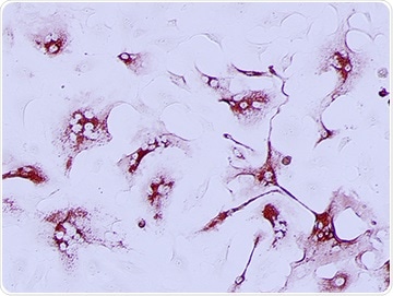 Researchers identify new therapeutic target to fight COVID-19 disease