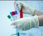Periodontal or gum disease recognized as significant risk factor for metabolic syndrome