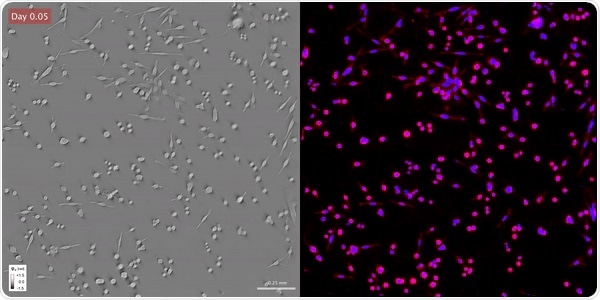 Researchers use novel technique to visualize unlabeled live cells