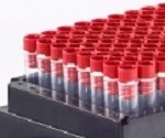 Compact Rack Scanner for Easy Liquid Handling Robot Integration