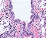 ‘Staining’ of Biological Samples when Using Electron Microscopy: Why stain density matters