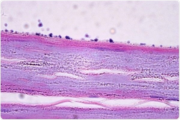 Staphylococci—Testing for dysbiosis in eczema.
