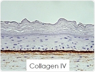 Basement membrane analysis.
